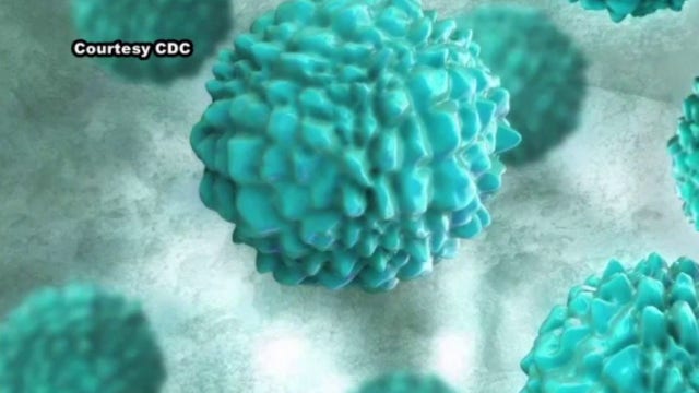 Cyclosporiasis Michigan outbreak: Cases rise to 5,002 Friday