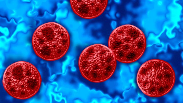 Cyclosporiasis Michigan outbreak: Case count at 6,571 Tuesday
