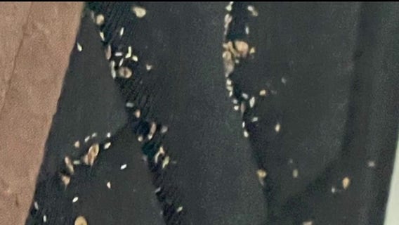 Harper Woods senior housing complex allegedly infested with bed bugs, residents say