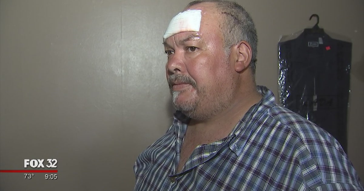 Chicago man struck by stray bullet in head while sleeping in bed | FOX ...
