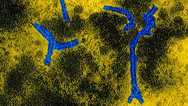 Senators urge review after mumps cases at immigrant center