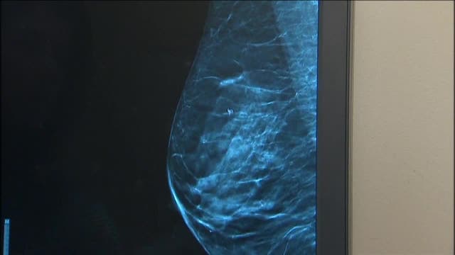Researchers make breakthrough in link between sugar and cancer