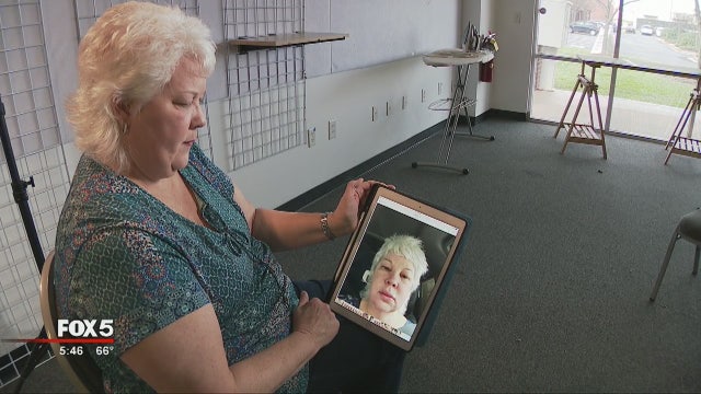 Tick bite triggers woman's red meat allergy