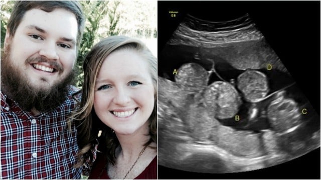 Georgia couple expecting quadruplet girls