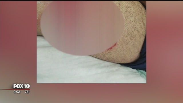 Man claims e-cigarette battery exploded in his pocket, suffers 2nd degree burns