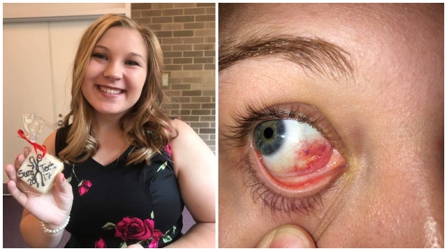 Doctor operated on wrong eye, tried to fix mistake with no anesthesia: lawsuit
