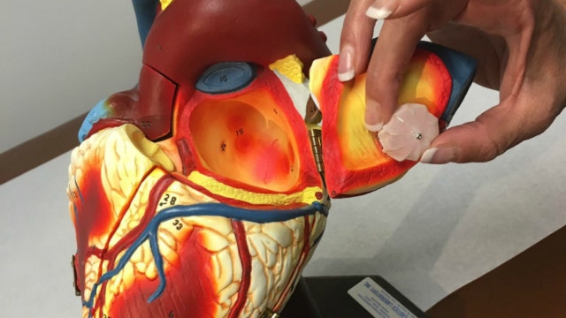 New implantable device could prevent strokes