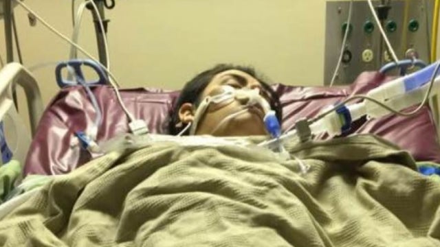 Northern California botulism outbreak: Teen struggling to recover from tainted nacho cheese