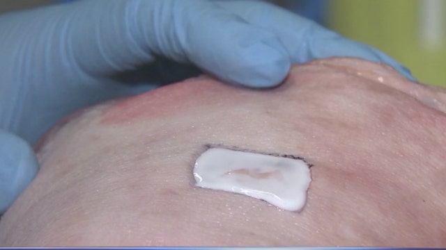 Chicago researchers develop new bandage that accelerates healing