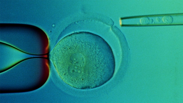 Second man seems to be free of AIDS virus after transplant