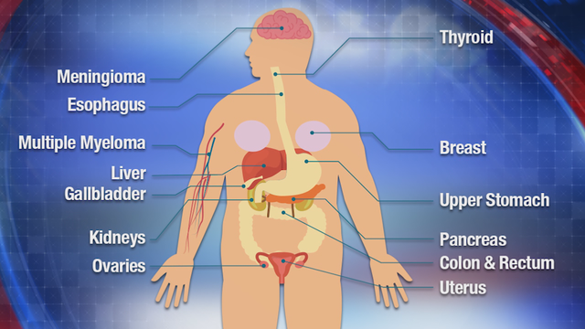 CDC: 40 percent of new cancers tied to being overweight