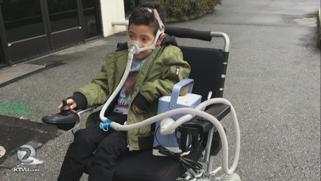East Bay boy with cystic fibrosis receives rare double-lung transplant