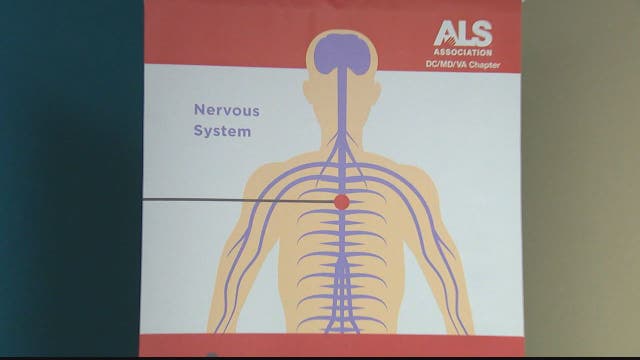 For first time in 22 years, new drug to treat ALS approved by FDA