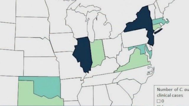 Superbug fungus cases rising in Chicago