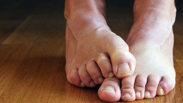 New procedure takes away foot pain caused by osteoarthritis