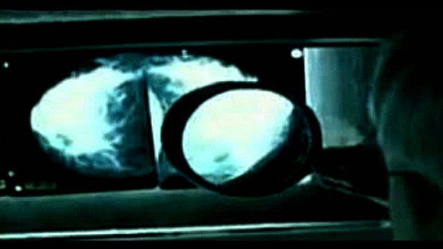 Breast imaging operations suspended at radiology center because of 'serious health risk'
