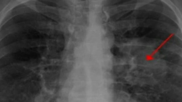 Scientists expect cure for cancer in 1 year