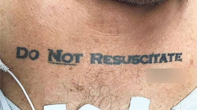 'Do Not Resuscitate' tattoo causes ER ethical dilemma