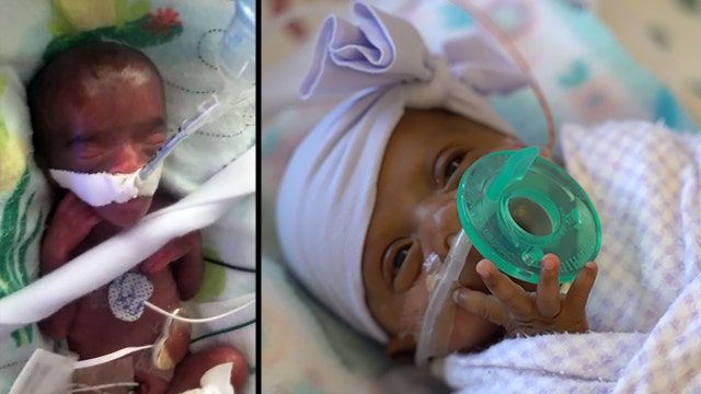 Girl believed to be world's tiniest surviving baby finally sent home from hospital