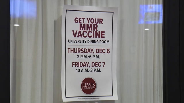Lewis University fighting mumps outbreak