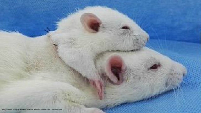 Doctor claims he transplanted rat's head; says human head transplants are next