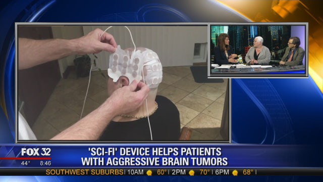 New treatment using electrodes to disrupt and kill brain cancer cells
