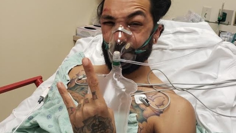 416605d0-scooter-injury-gofundme_1561554578170.jpg