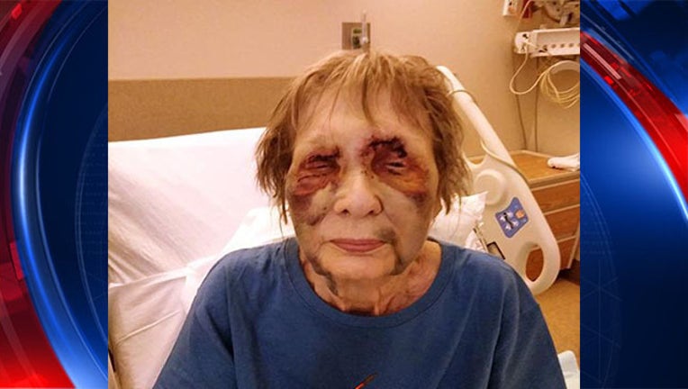 84621a4a-80 yearold beaten raped_1530906523832.jpg-403440.jpg