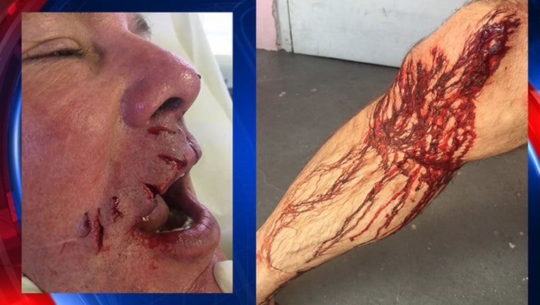 b173eb26-shark attack dentist-409650