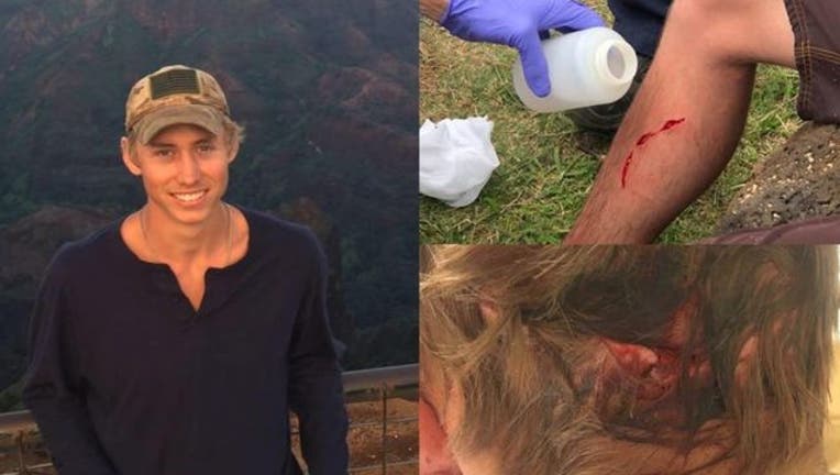 d44f271e-Dylan McWilliams has survived attacks from a bear, a rattlesnake and a shark