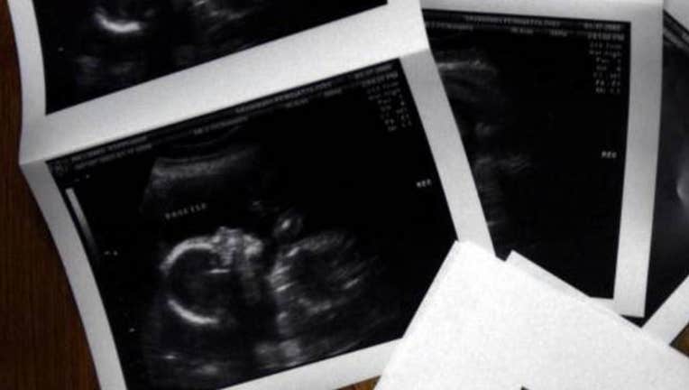 e4b635b4-GETTY Baby Ultrasound_1551908293109.jpg-408200.jpg