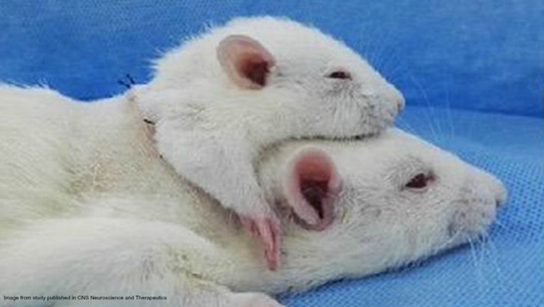 eb02af94-Image from study published in CNS Neuroscience and Therapeutics