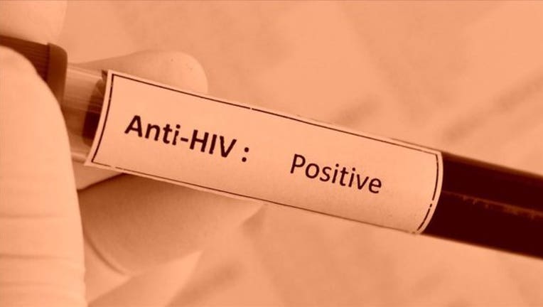 f93501d2-hiv-positive.jpg