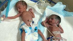 'World's oldest mom' gives birth to twins at age 74, hospital claims