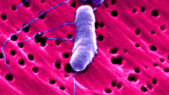 ‘It took my dad's life': Flesh-eating bacteria kills man within 48 hours of beach trip