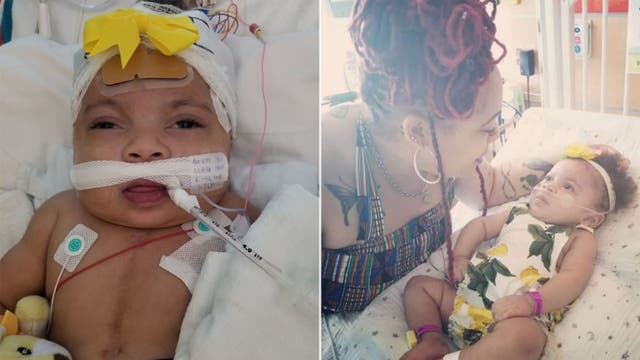 Miracle baby born with severe heart disease, taken off life support, about to celebrate 1st birthday