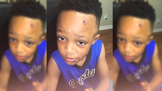 Mom horrified when son, 7, returns from school with bullet hole painted on face