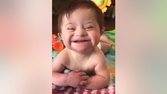 Video of adopted girl with Down syndrome smiling from ear to ear goes viral
