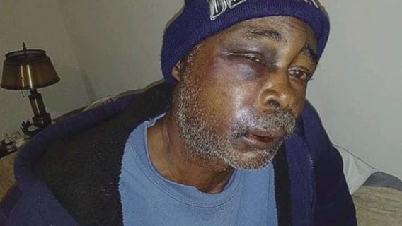 Vietnam veteran from Detroit beat up at bus station on Gratiot, left bloody in middle of road