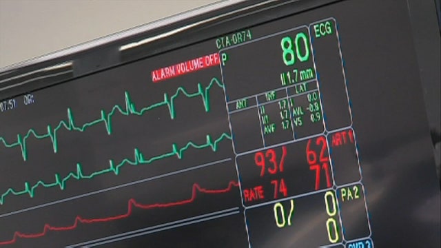 New study casts doubt on need for many heart procedures
