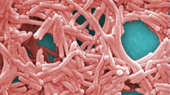 Legionnaires’ case confirmed at a Bolingbrook senior home