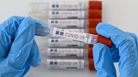 Cook County at 'High Community Level' for COVID-19 as state reports 27,094 new cases since last Friday