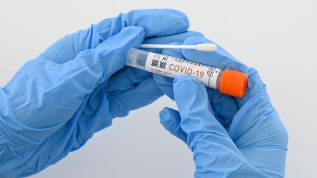 Drool, please: University of Illinois rolls out saliva tests for coronavirus