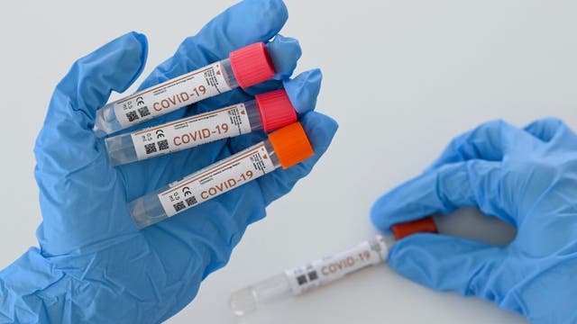 Illinois reports 7,359 new coronavirus cases, 117 more deaths