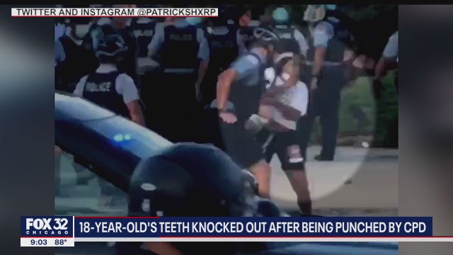 Chicago police officer punched teenager in mouth during protest, activists say