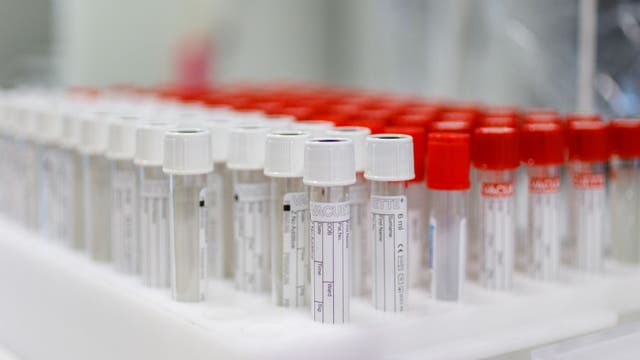 Illinois reports 9,277 new COVID-19 cases, 126 more deaths