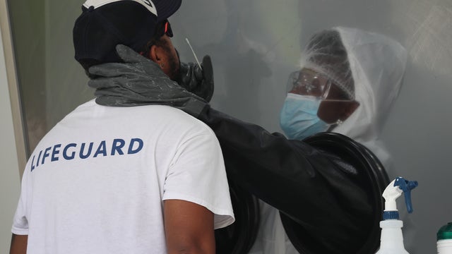 Florida now has 423,855 coronavirus cases, more than New York State; median age of patients is 40