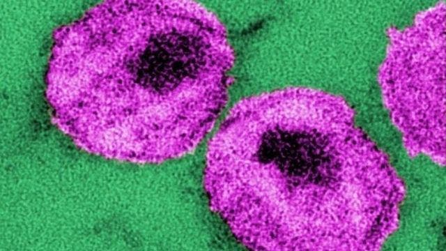 Doctors say experimental treatment may have rid man of HIV