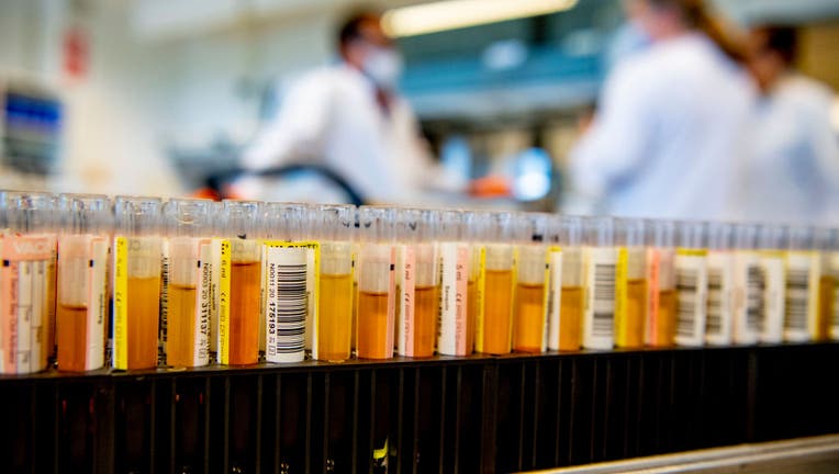 FILE - Test tubes with blood samples seen at the lab center.