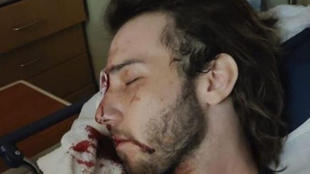 Indiana man who lost eye after being shot with tear gas is now suing police